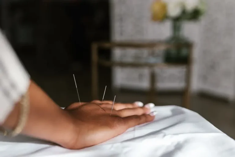 7 Essential Tips for Athletes Using Acupuncture Needles for Pain Management