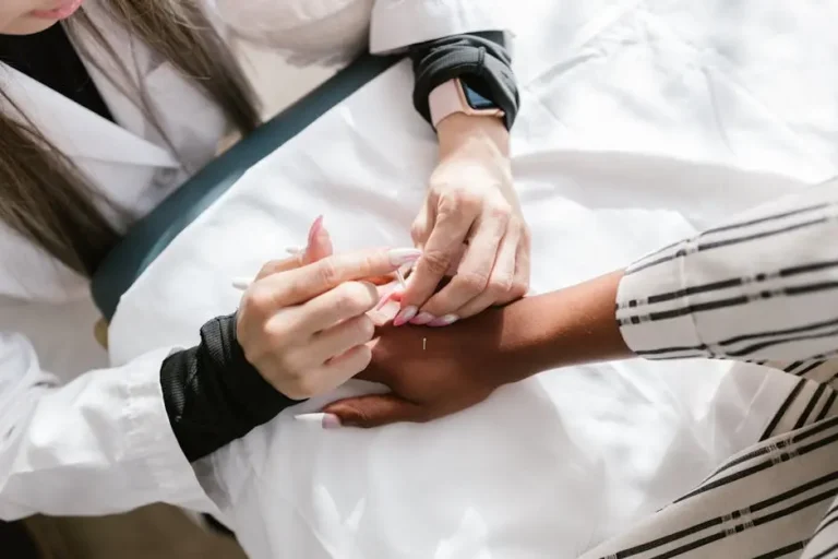 Unlocking Athletic Potential with San Francisco Acupuncture