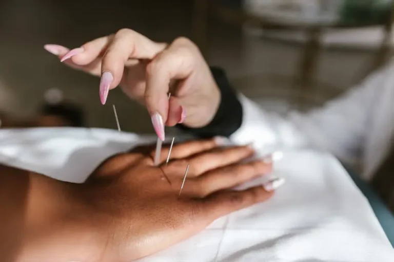 7 Fascinating Facts About Acupuncture Needles and Pain Relief