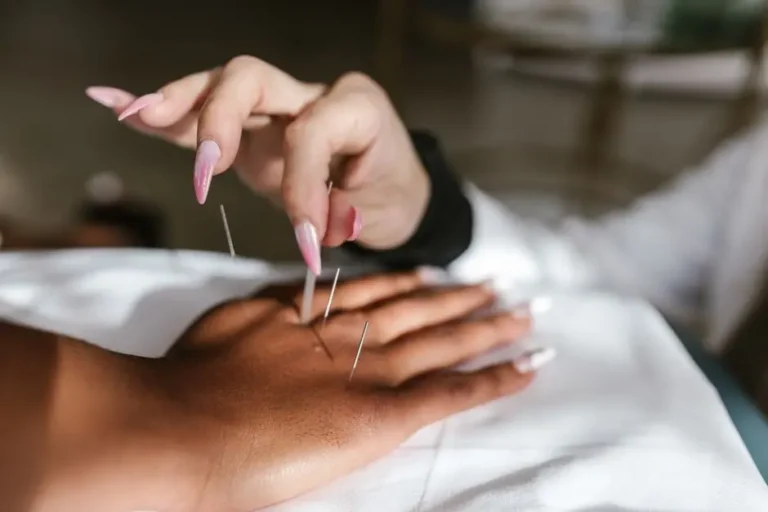 How Acupuncture Enhances Pain Management and Boosts Recovery